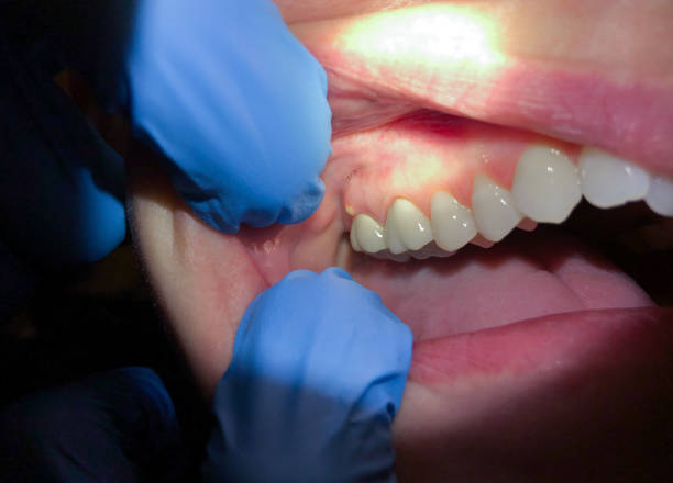 Best Emergency Gum Treatment in Waikoloa Village, HI