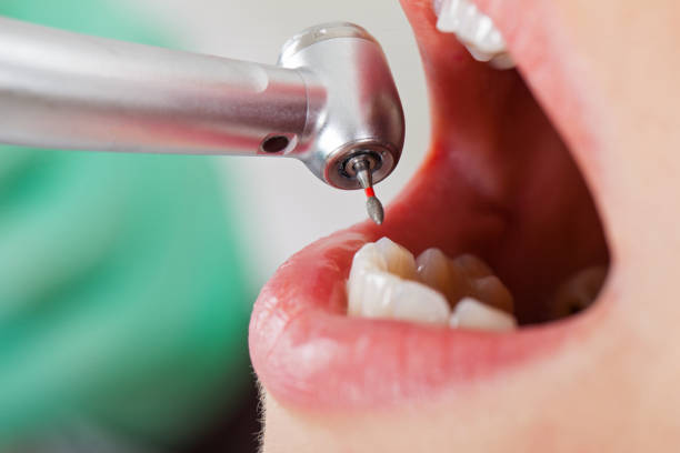Best Emergency Treatment for Dental Infections or Abscesses in Waikoloa Village, HI